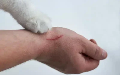 Can You Get Rabies from a Cat Scratch? 9 Facts Every Cat Owner Must Know